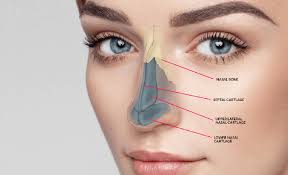 Rhinoplasty